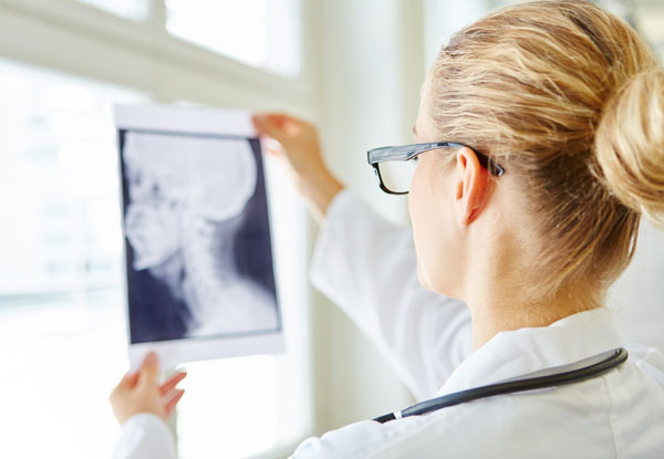 dr holding up xray to view